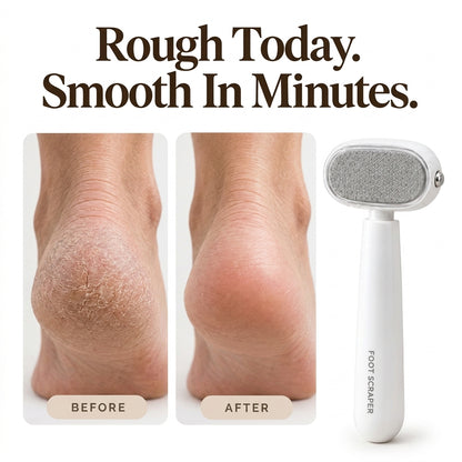 Zelviros™-Guarded Callus Peeler